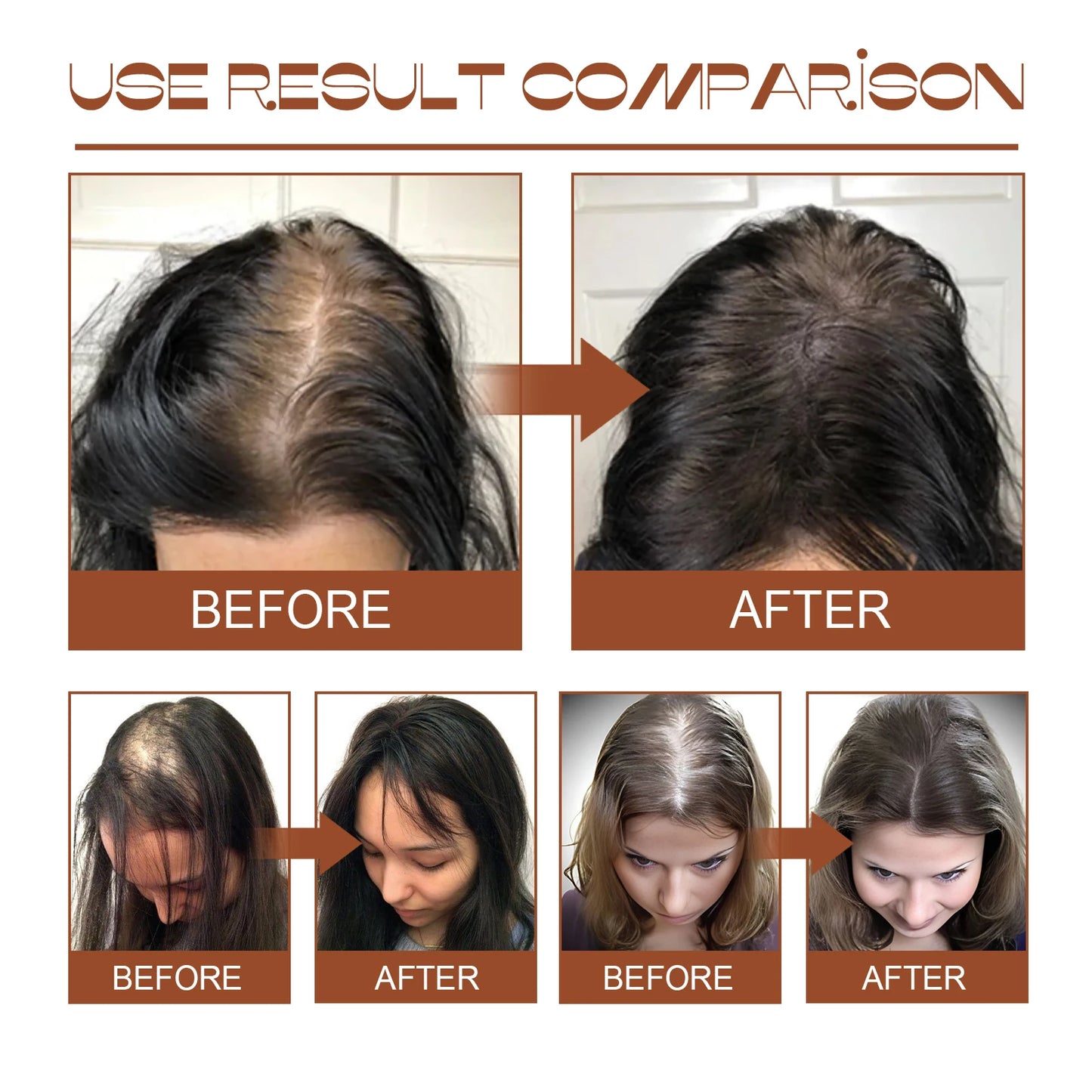 Batana Boost Hair Repair Mask